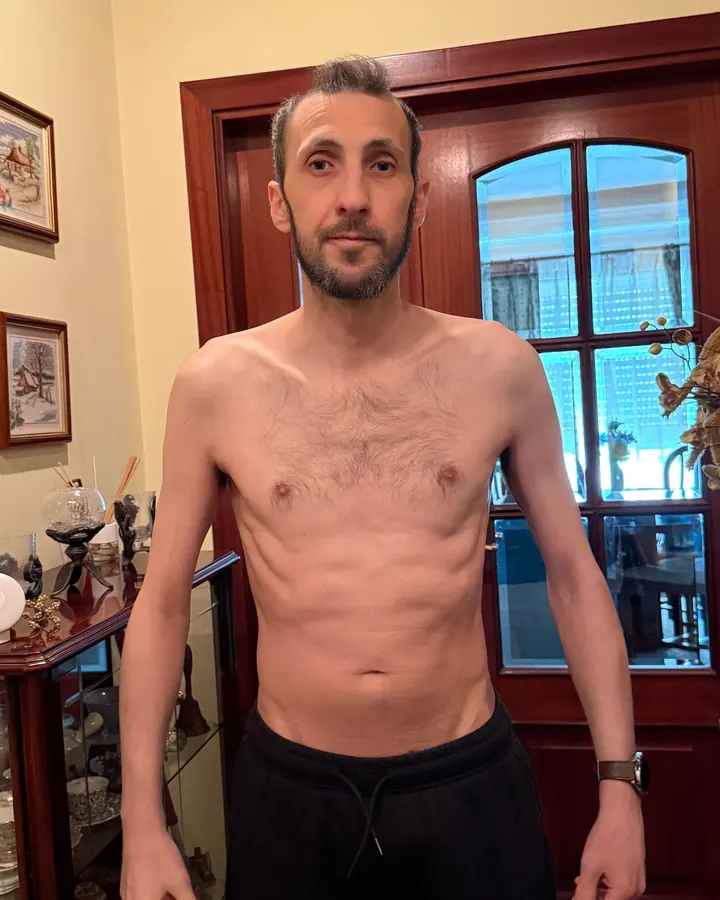 O fundador em casa, em tronco nu, no início da recuperação: muito magro, de pé no corredor.